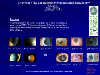 Chameleon-like appearance of immunotactoid keratopathy