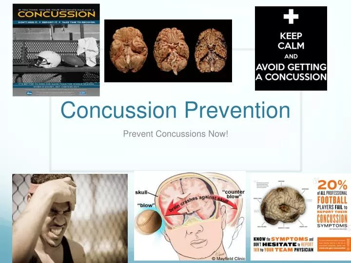 concussion prevention