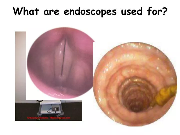 what are endoscopes used for
