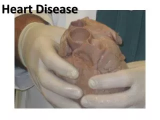 Heart Disease