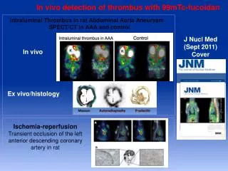 In vivo detection of thrombus with 99mTc-fucoidan