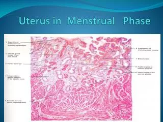 Uterus in Menstrual Phase