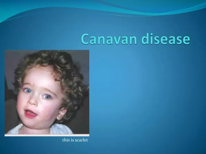 c anavan disease