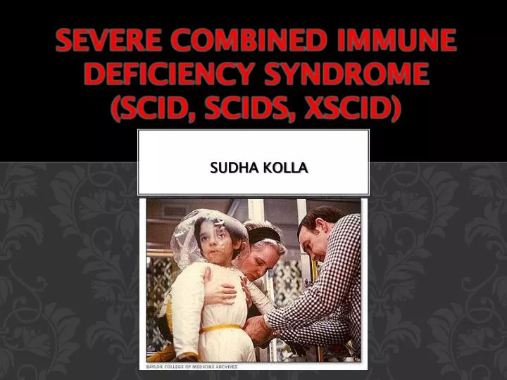 severe combined immune deficiency syndrome scid scids xscid