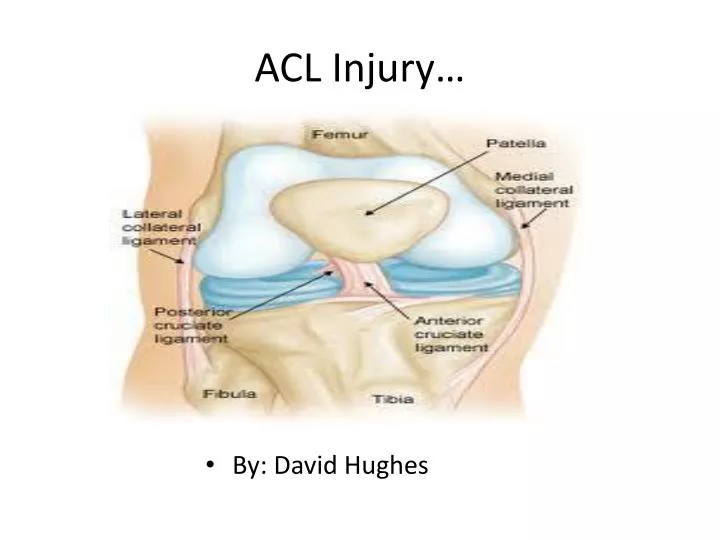 acl injury