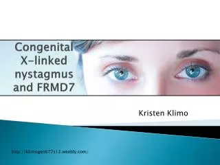 Congenital X-linked nystagmus and FRMD7