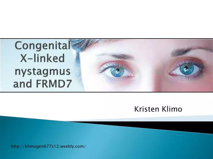 congenital x linked nystagmus and frmd7