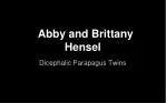 Abby and Brittany Hensel - slide 1