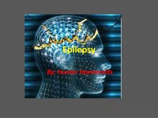 epilepsy