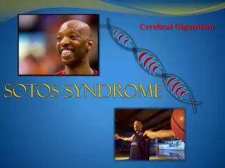 Sotos Syndrome