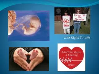 2.1b Right To Life