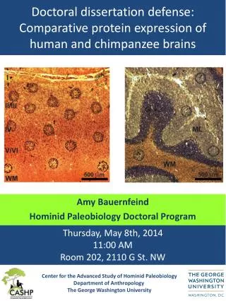 Doctoral dissertation defense: Comparative protein expression of human and chimpanzee brains