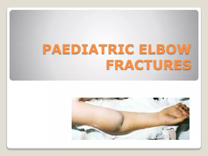 paediatric elbow fractures
