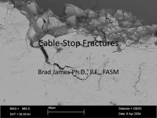 Cable-Stop Fractures