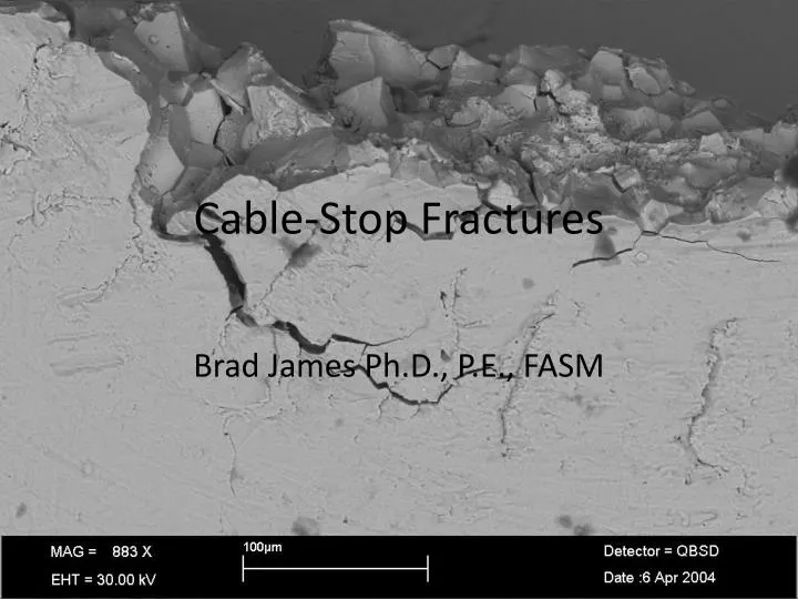 cable stop fractures