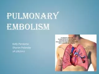 Pulmonary Embolism