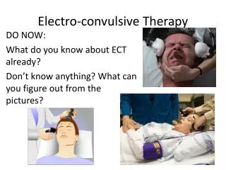 Electro-convulsive Therapy