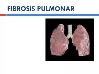 fibrosis pulmonar