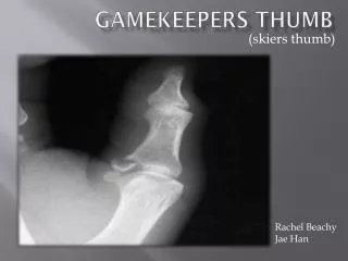 Gamekeepers Thumb