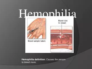 Hemophilia definition : Causes the person to bleed more.