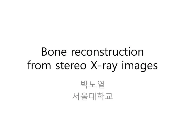 bone reconstruction from stereo x ray images