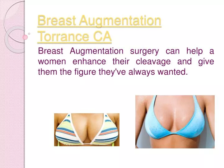 breast augmentation torrance ca