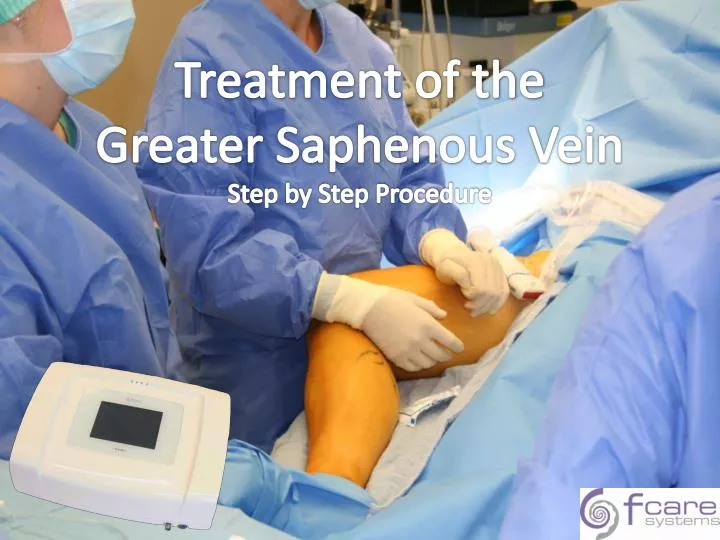 treatment of the greater saphenous vein step by step p rocedure