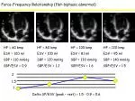 Understanding Force-Frequency Relationship in Cardiac Function: An Analysis of Flat-Biphasic Abnormality - slide 1
