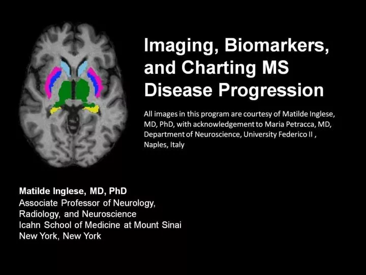 imaging biomarkers and charting ms disease progression