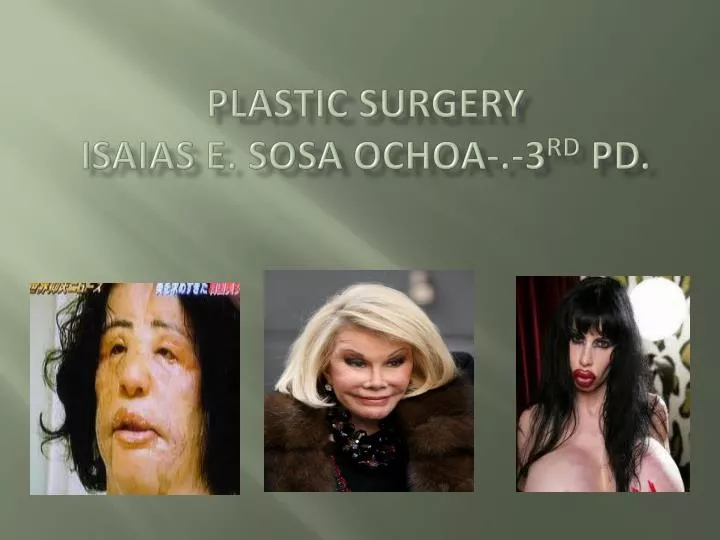 plastic surgery isaias e sosa ochoa 3 rd pd