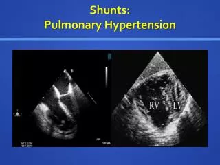 Shunts: Pulmonary Hypertension