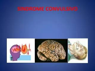 sindrome convulsivo