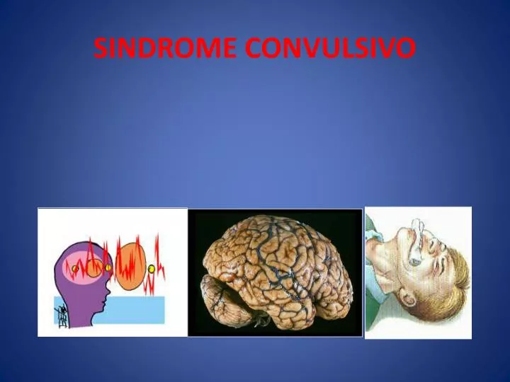 sindrome convulsivo