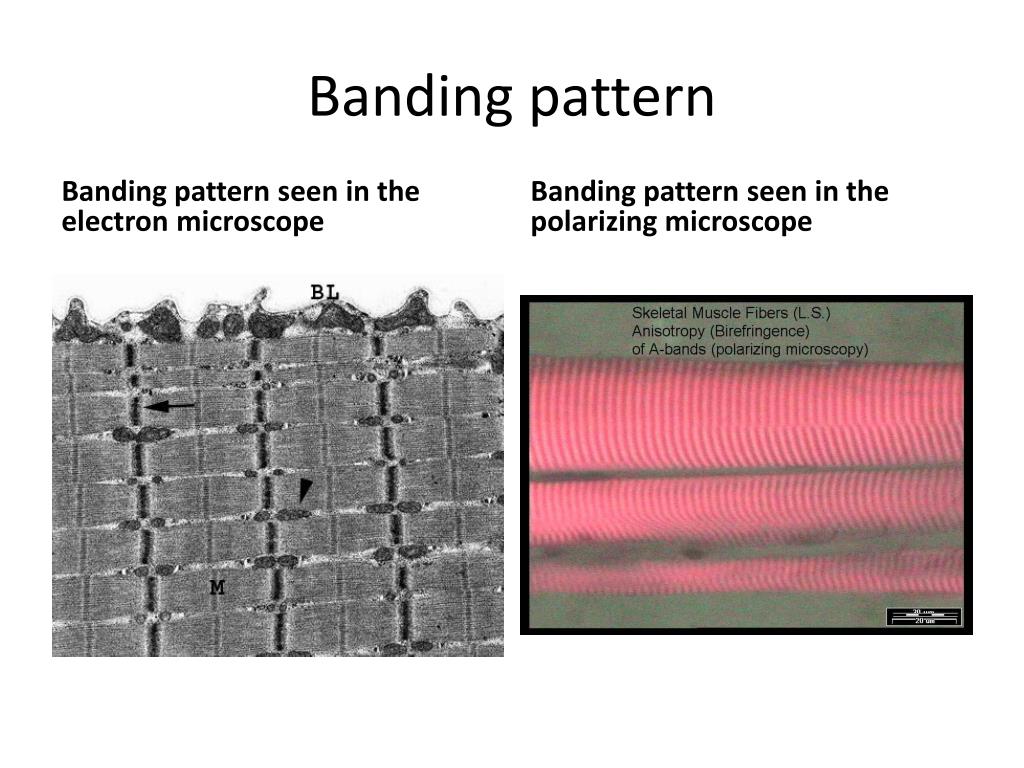 PPT - Banding pattern PowerPoint Presentation, free download - ID:2842430