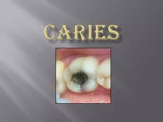 caries