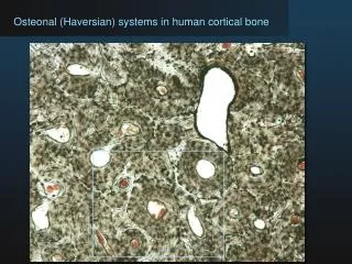 Osteonal (Haversian) systems in human cortical bone