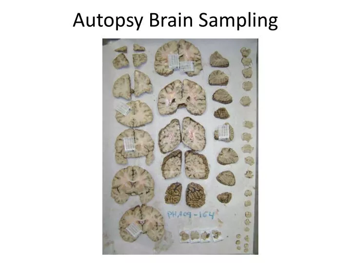 autopsy brain sampling