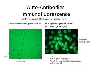 Auto-Antibodies Immunofluorescence