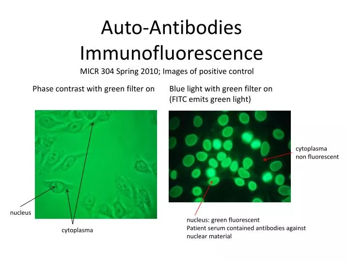 auto antibodies immunofluorescence
