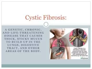 Cystic Fibrosis: