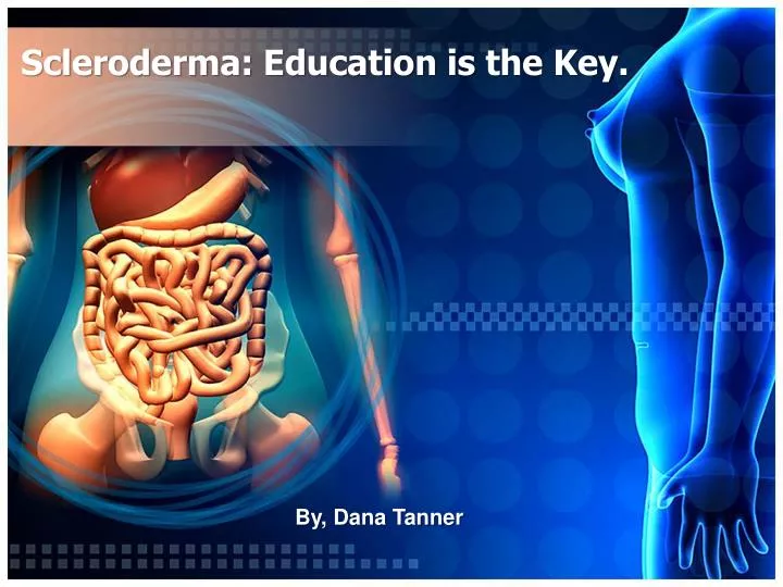 scleroderma education is the key