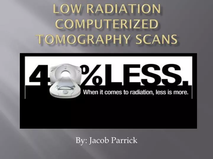 low radiation computerized tomography scans