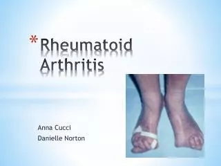 Rheumatoid Arthritis