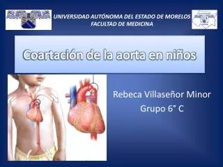 coartaci n de la aorta en ni os