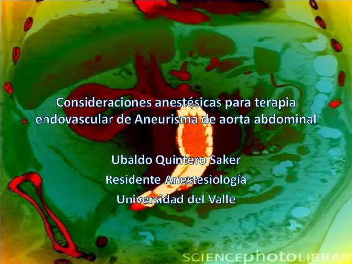 consideraciones anest sicas para terapia endovascular de aneurisma de aorta abdominal