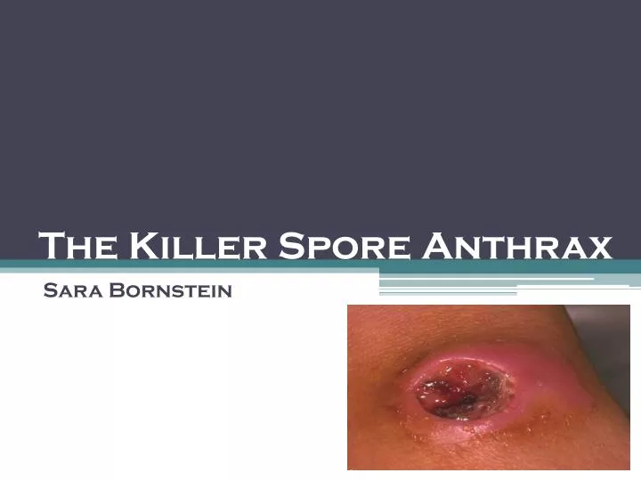 the killer spore anthrax
