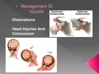 Management Of Injuries