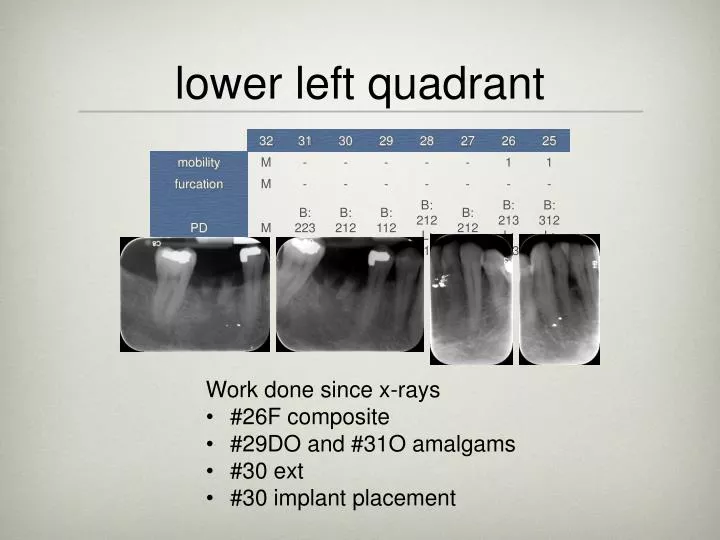 lower left quadrant