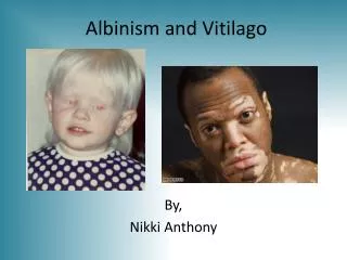 Albinism and Vitilago