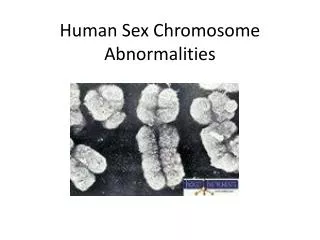 Human Sex Chromosome Abnormalities